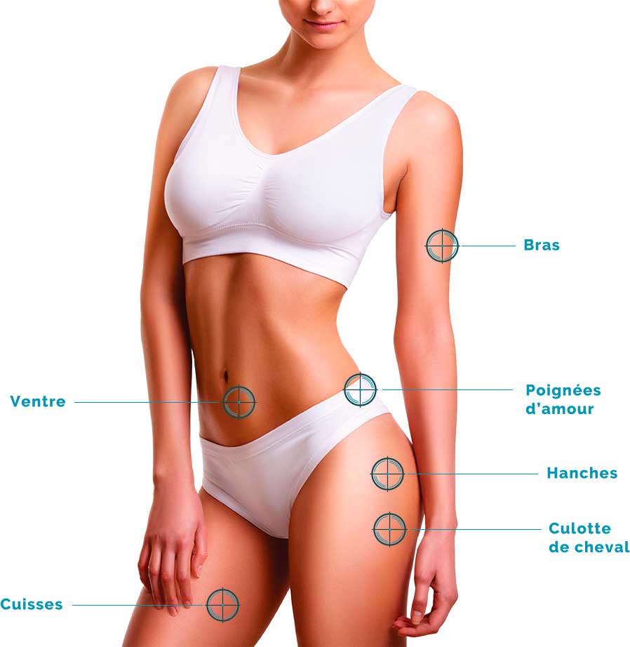 tarifs visuel-la-cryolipolyse